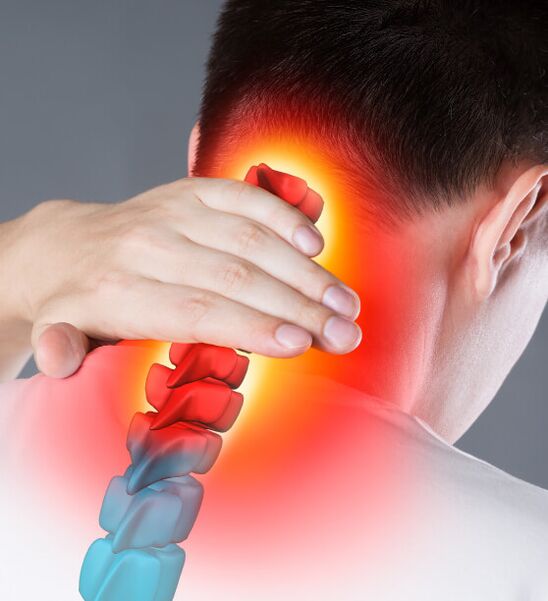 Symptoms of cervical osteochondrose